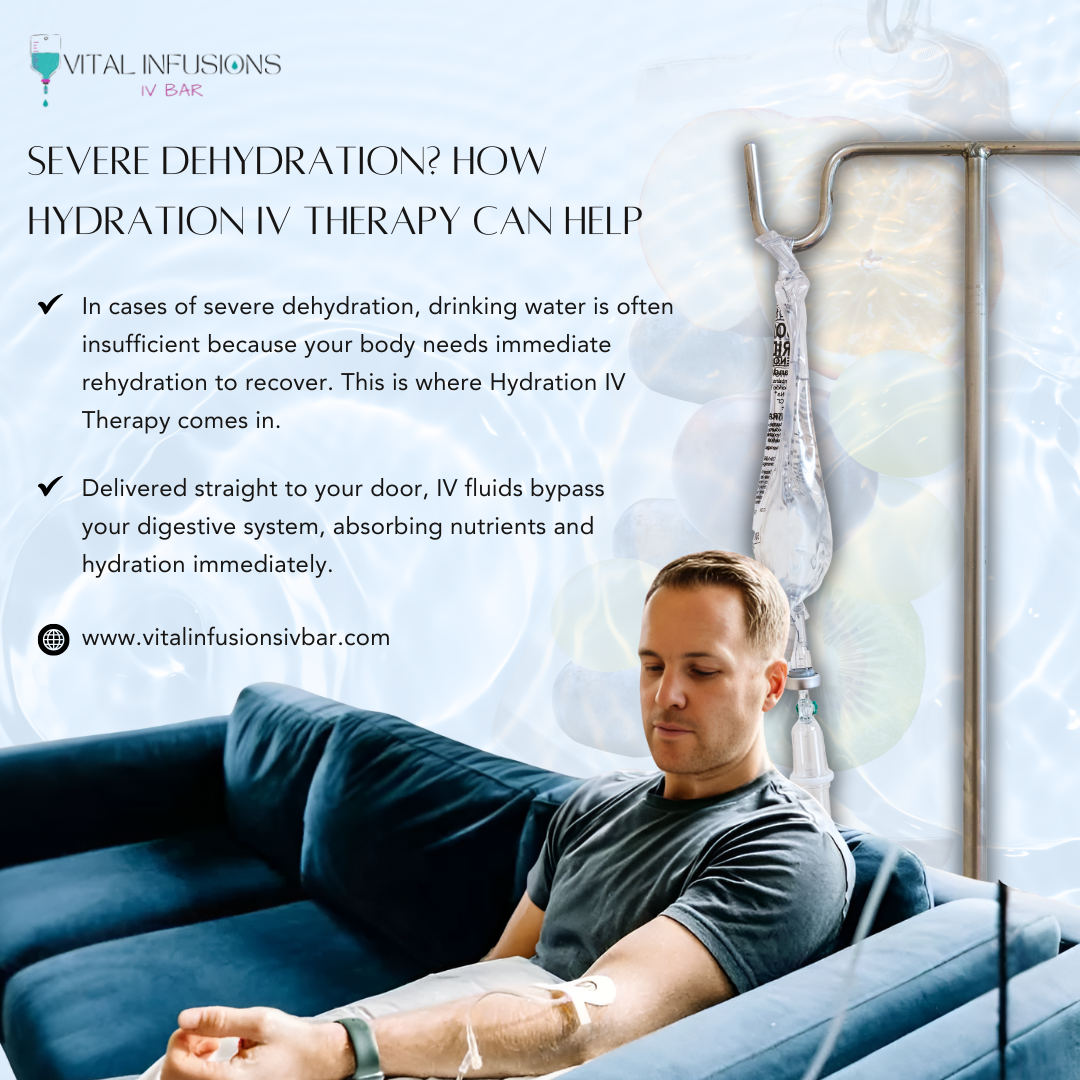 Severe Dehydration? How Hydration IV Therapy Can Help